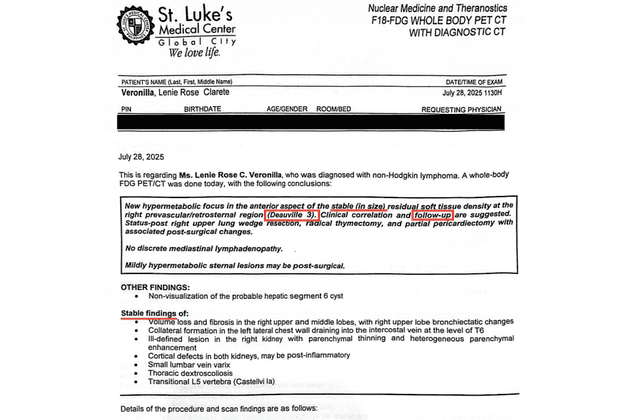 Recent PET CT result